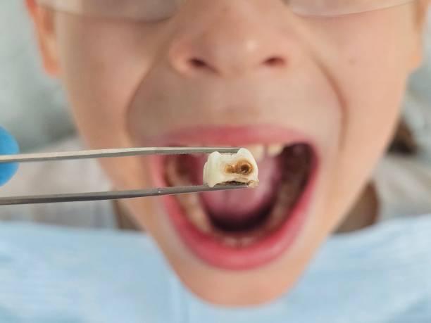 Best Emergency Treatment for Toothache in Benson, AZ