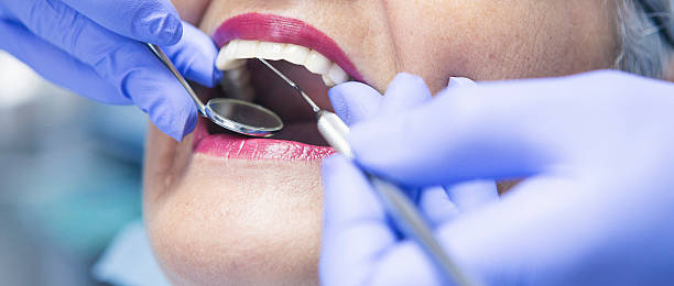 Best Emergency Broken Tooth Repair in Benson, AZ